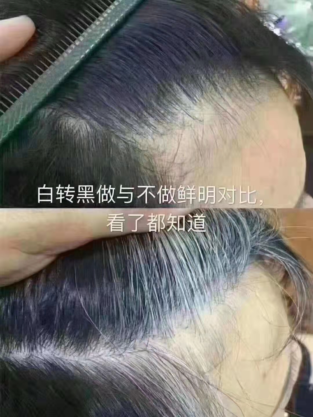 白发转黑