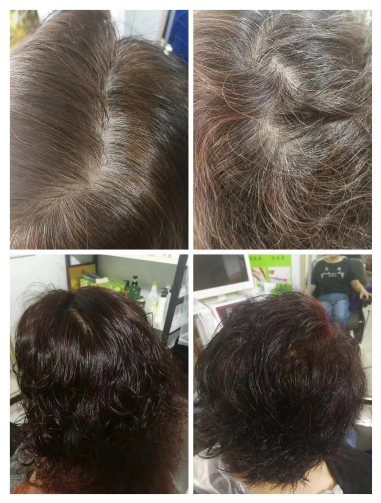 秀丝顿植物养发头疗是国内行业标杆，选择秀丝顿植物养发头疗是您最好的选择。